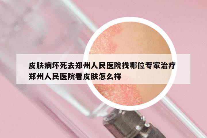 皮肤病坏死去郑州人民医院找哪位专家治疗 郑州人民医院看皮肤怎么样