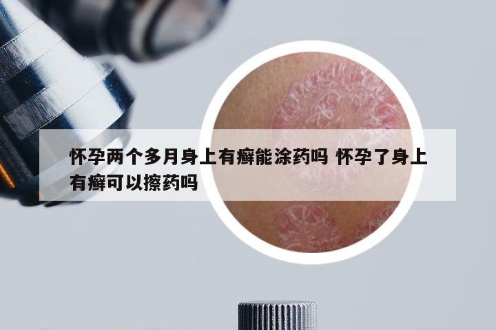 怀孕两个多月身上有癣能涂药吗 怀孕了身上有癣可以擦药吗