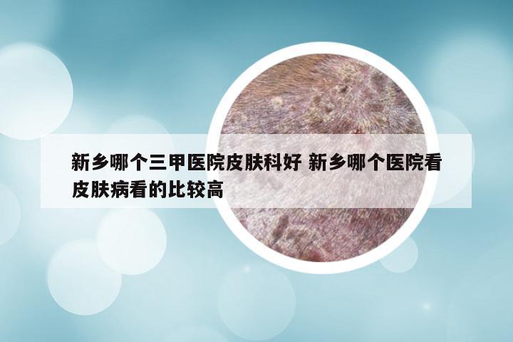 新乡哪个三甲医院皮肤科好 新乡哪个医院看皮肤病看的比较高