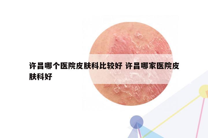 许昌哪个医院皮肤科比较好 许昌哪家医院皮肤科好