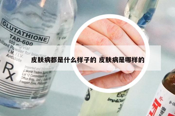 皮肤病都是什么样子的 皮肤病是哪样的