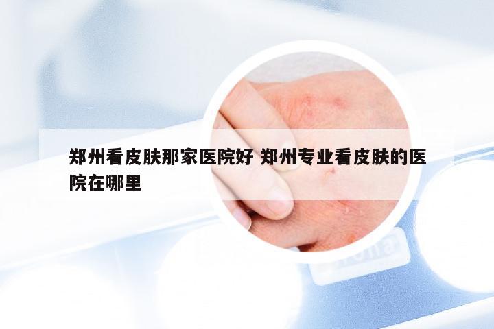 郑州看皮肤那家医院好 郑州专业看皮肤的医院在哪里