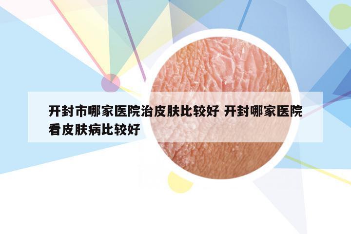 开封市哪家医院治皮肤比较好 开封哪家医院看皮肤病比较好