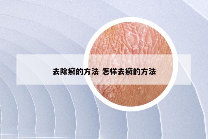 去除癣的方法 怎样去癣的方法