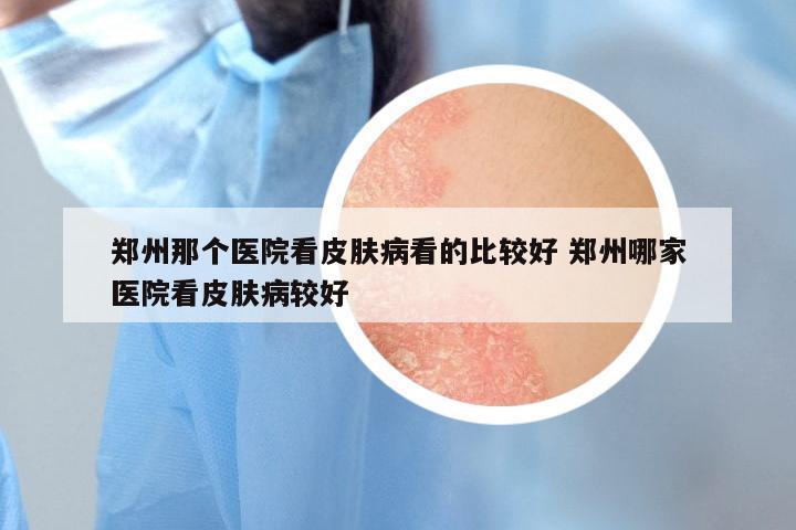 郑州那个医院看皮肤病看的比较好 郑州哪家医院看皮肤病较好