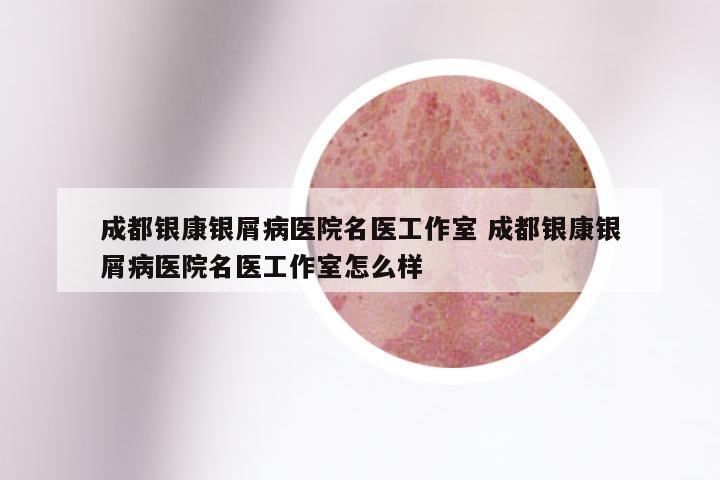 成都银康银屑病医院名医工作室 成都银康银屑病医院名医工作室怎么样