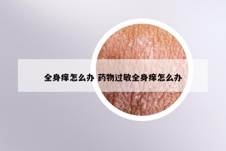 全身痒怎么办 药物过敏全身痒怎么办
