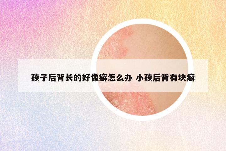 孩子后背长的好像癣怎么办 小孩后背有块癣