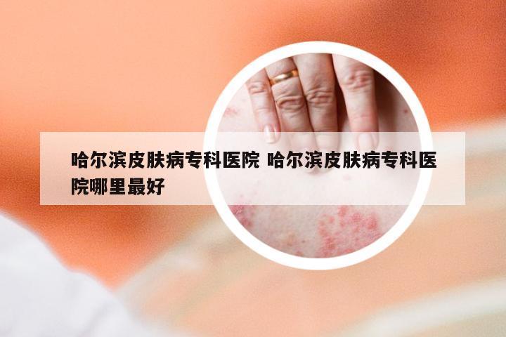 哈尔滨皮肤病专科医院 哈尔滨皮肤病专科医院哪里最好