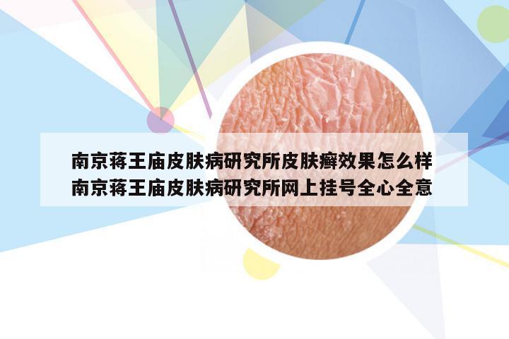 南京蒋王庙皮肤病研究所皮肤癣效果怎么样 南京蒋王庙皮肤病研究所网上挂号全心全意