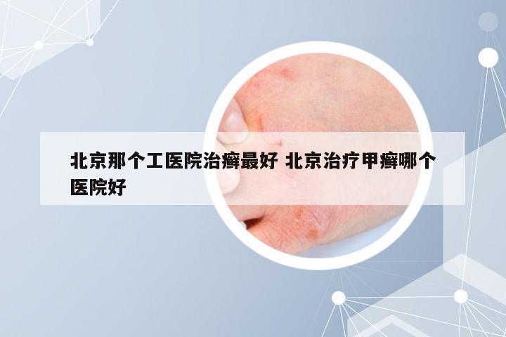 北京那个工医院治癣最好 北京治疗甲癣哪个医院好