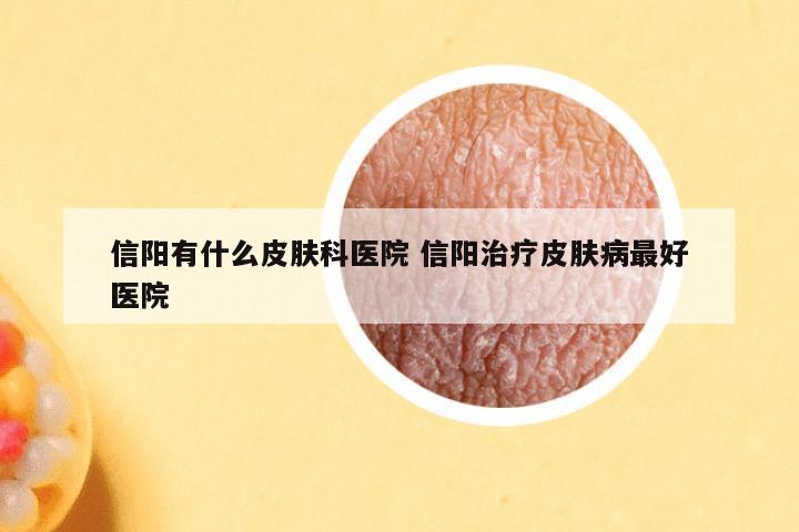 信阳有什么皮肤科医院 信阳治疗皮肤病最好医院