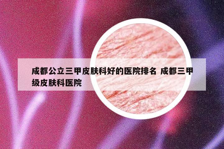成都公立三甲皮肤科好的医院排名 成都三甲级皮肤科医院