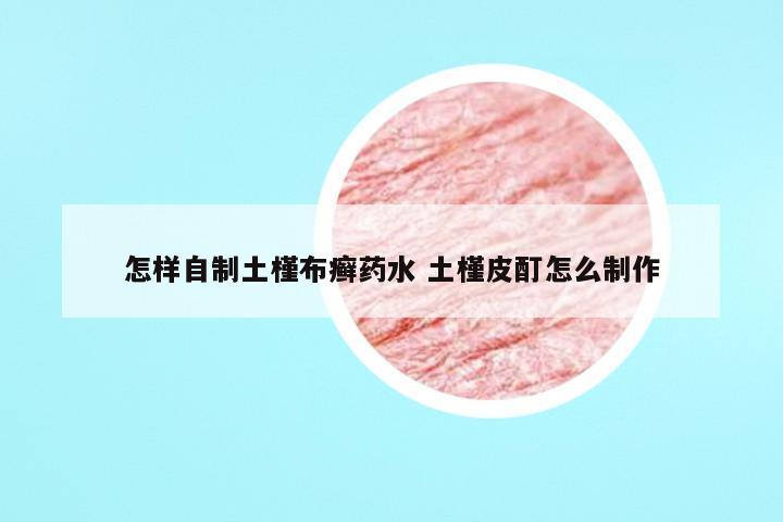 怎样自制土槿布癣药水 土槿皮酊怎么制作