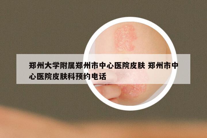郑州大学附属郑州市中心医院皮肤 郑州市中心医院皮肤科预约电话