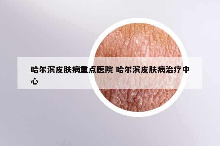 哈尔滨皮肤病重点医院 哈尔滨皮肤病治疗中心