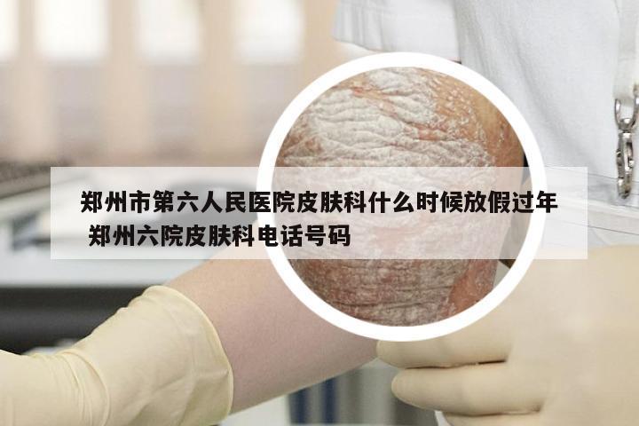 郑州市第六人民医院皮肤科什么时候放假过年 郑州六院皮肤科电话号码