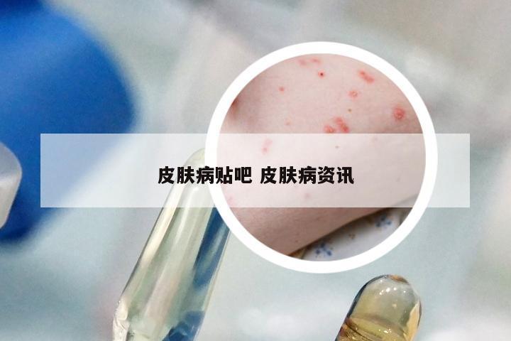 皮肤病贴吧 皮肤病资讯