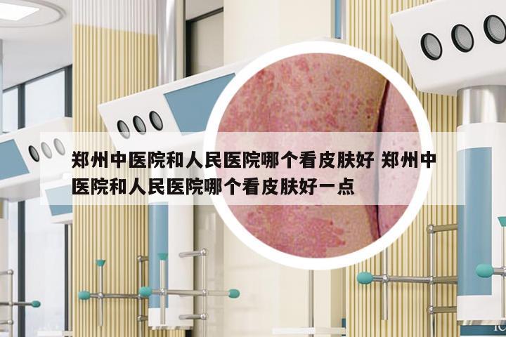 郑州中医院和人民医院哪个看皮肤好 郑州中医院和人民医院哪个看皮肤好一点