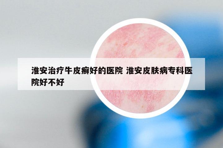淮安治疗牛皮癣好的医院 淮安皮肤病专科医院好不好