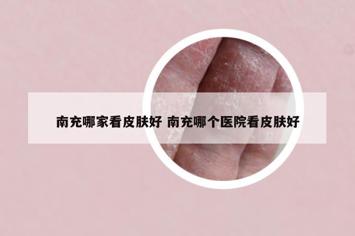 南充哪家看皮肤好 南充哪个医院看皮肤好