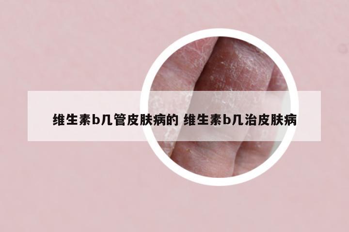 维生素b几管皮肤病的 维生素b几治皮肤病