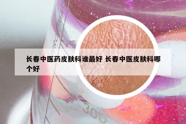 长春中医药皮肤科谁最好 长春中医皮肤科哪个好