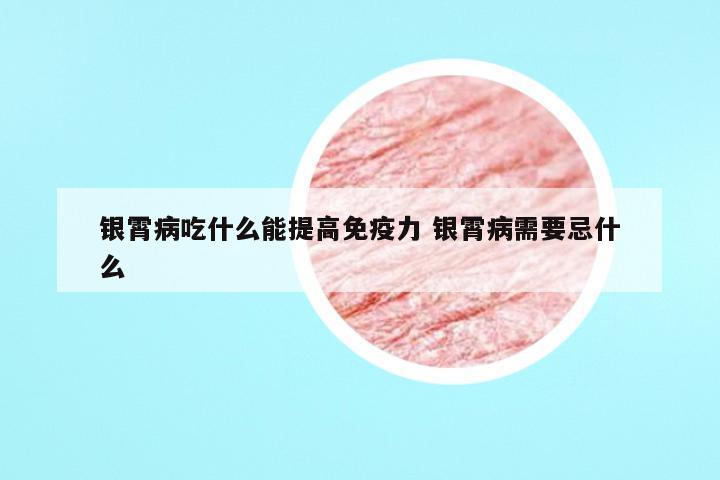 银霄病吃什么能提高免疫力 银霄病需要忌什么