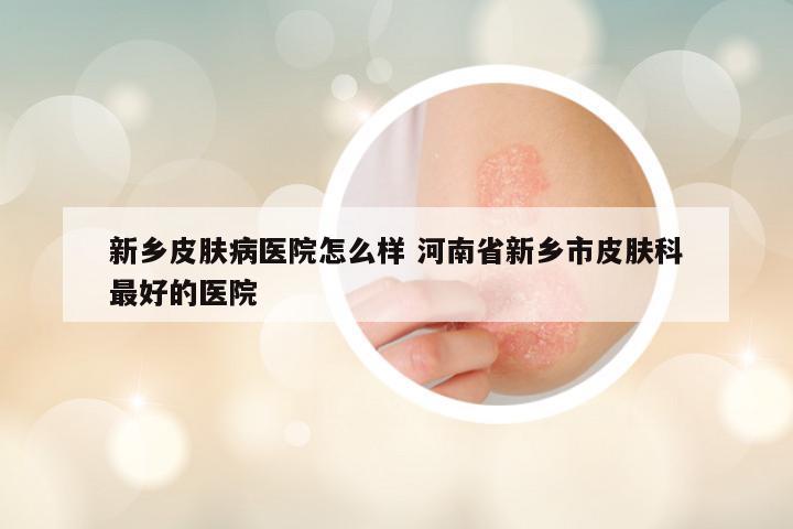 新乡皮肤病医院怎么样 河南省新乡市皮肤科最好的医院