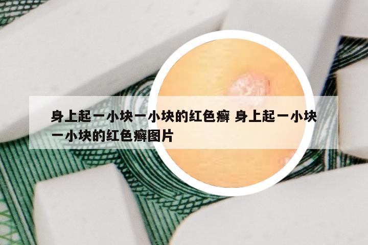身上起一小块一小块的红色癣 身上起一小块一小块的红色癣图片