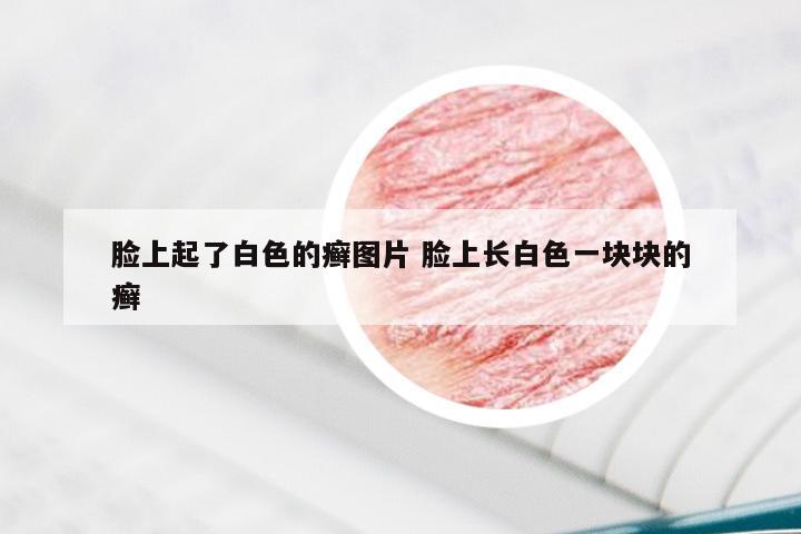 脸上起了白色的癣图片 脸上长白色一块块的癣