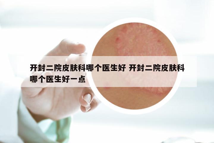 开封二院皮肤科哪个医生好 开封二院皮肤科哪个医生好一点