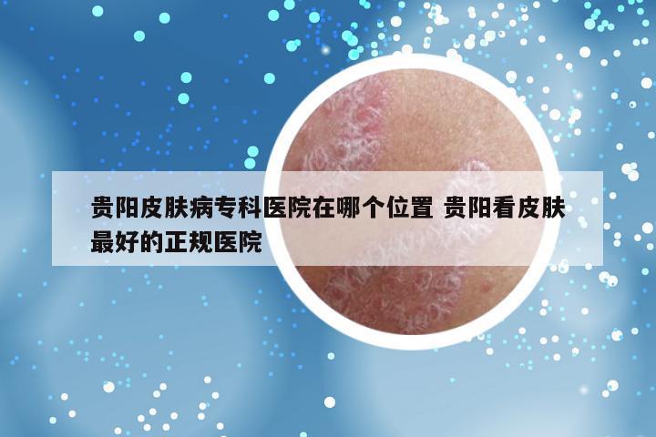 贵阳皮肤病专科医院在哪个位置 贵阳看皮肤最好的正规医院