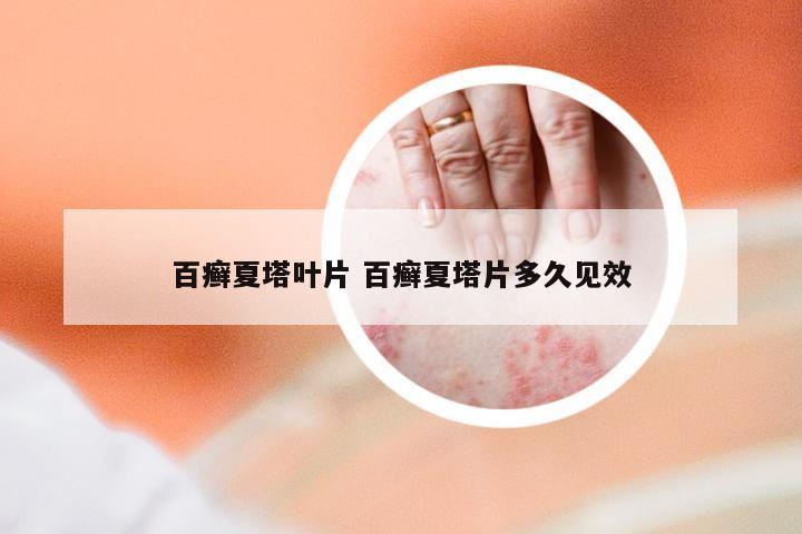 百癣夏塔叶片 百癣夏塔片多久见效
