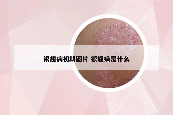 银翘病初期图片 银翘病是什么