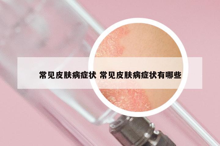 常见皮肤病症状 常见皮肤病症状有哪些