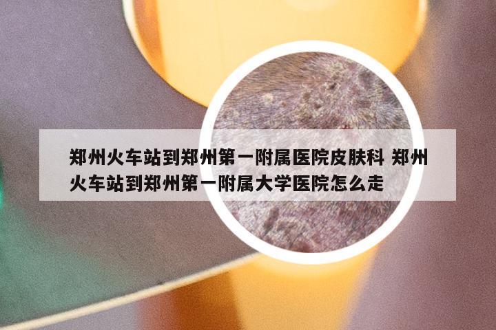 郑州火车站到郑州第一附属医院皮肤科 郑州火车站到郑州第一附属大学医院怎么走