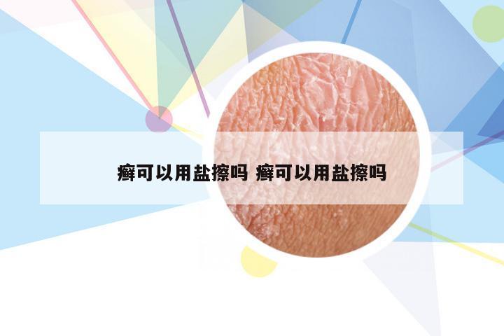 癣可以用盐擦吗 癣可以用盐擦吗