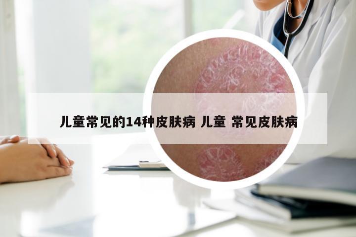儿童常见的14种皮肤病 儿童 常见皮肤病