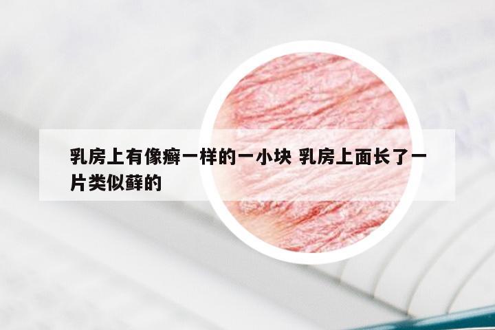 乳房上有像癣一样的一小块 乳房上面长了一片类似藓的