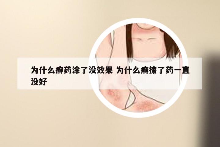 为什么癣药涂了没效果 为什么癣擦了药一直没好