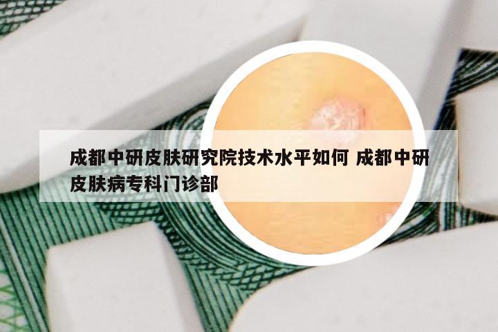 成都中研皮肤研究院技术水平如何 成都中研皮肤病专科门诊部