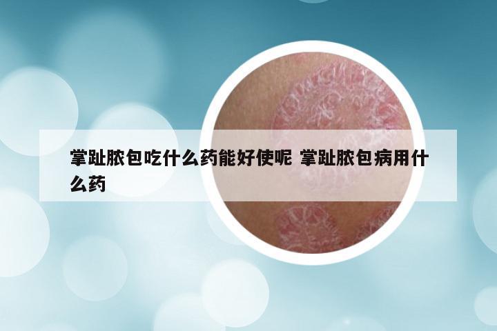 掌趾脓包吃什么药能好使呢 掌趾脓包病用什么药
