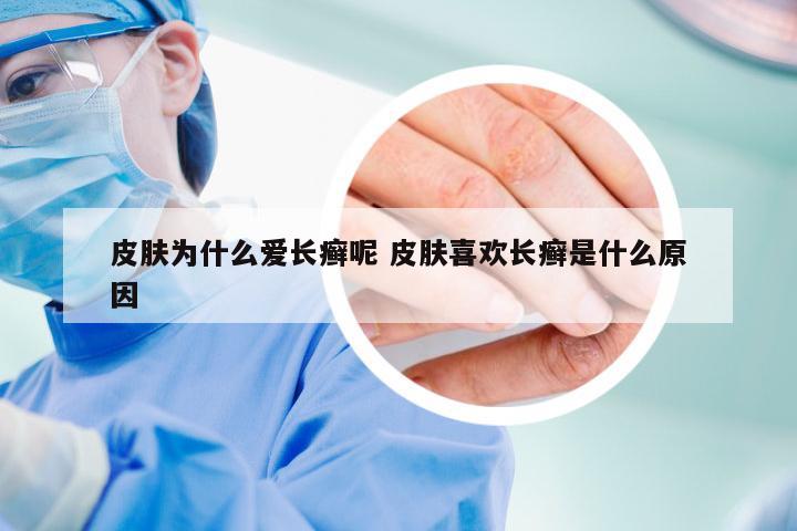 皮肤为什么爱长癣呢 皮肤喜欢长癣是什么原因