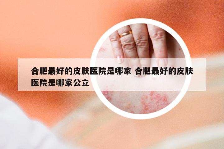 合肥最好的皮肤医院是哪家 合肥最好的皮肤医院是哪家公立