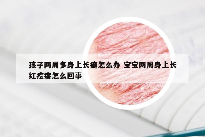 孩子两周多身上长癣怎么办 宝宝两周身上长红疙瘩怎么回事