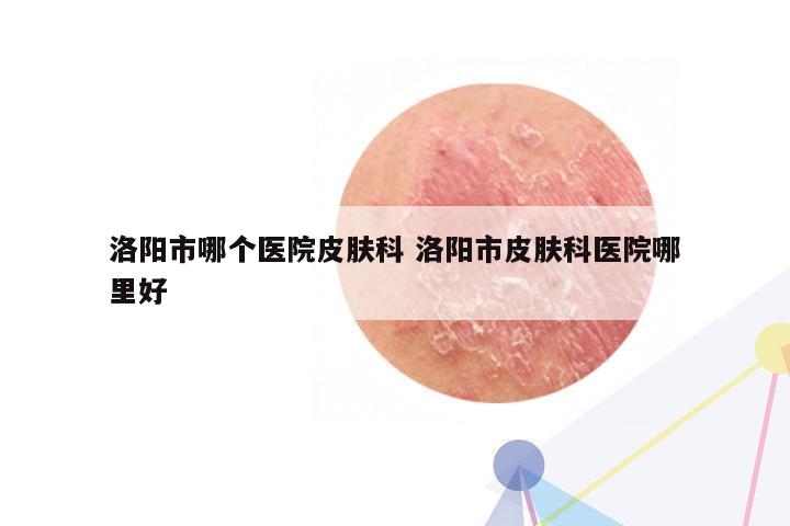 洛阳市哪个医院皮肤科 洛阳市皮肤科医院哪里好