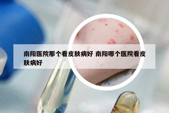南阳医院那个看皮肤病好 南阳哪个医院看皮肤病好