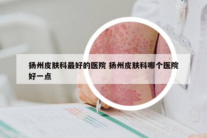 扬州皮肤科最好的医院 扬州皮肤科哪个医院好一点