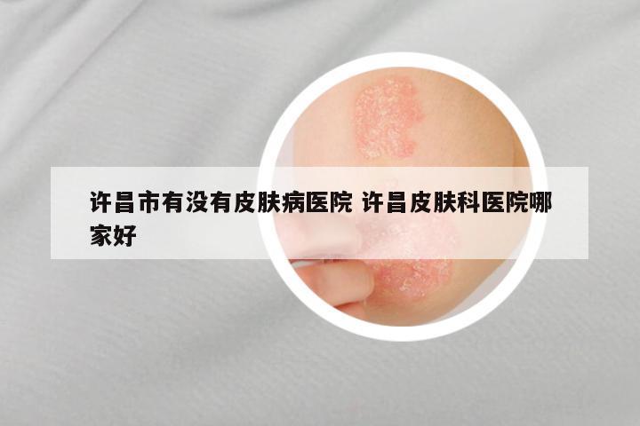 许昌市有没有皮肤病医院 许昌皮肤科医院哪家好